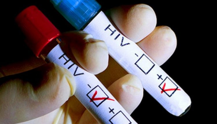 Hiv, a Napoli è boom d’infezioni: aumentate del 20% nel 2017. Giovani ed etero tra i più colpiti