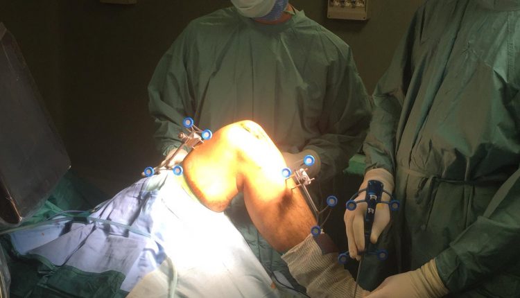 Ortopedia, all’ospedale Betania primo intervento chirurgico con robot dell’equipe  diretta dal dottor Giacomo Negri 