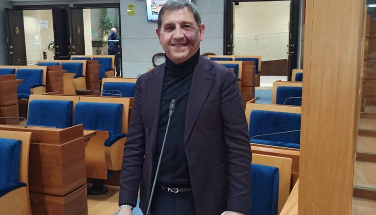 SULL’EMERGENZA COVID IN CAMPANIA – Michele Schiano di Visconti: “Dare colpa all’opposizione è solo populismo”