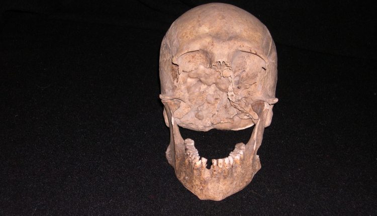 L’ultima rotta di Plinio il Vecchio: il presunto cranio simbolo di curiosità scientifica e solidarietà civile