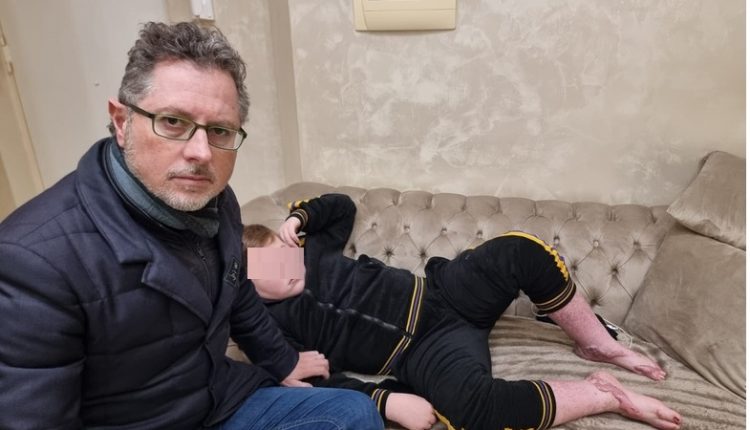 Bimbo ustionato a Sant’Anastasia: il deputato Borrelli fa visita al piccolo Manuel. “Gambe rovinate e stop alla scuola. Chi ha trasformato il marciapiede in una trappola deve pagare. Giustizia per un piccolo leone.”